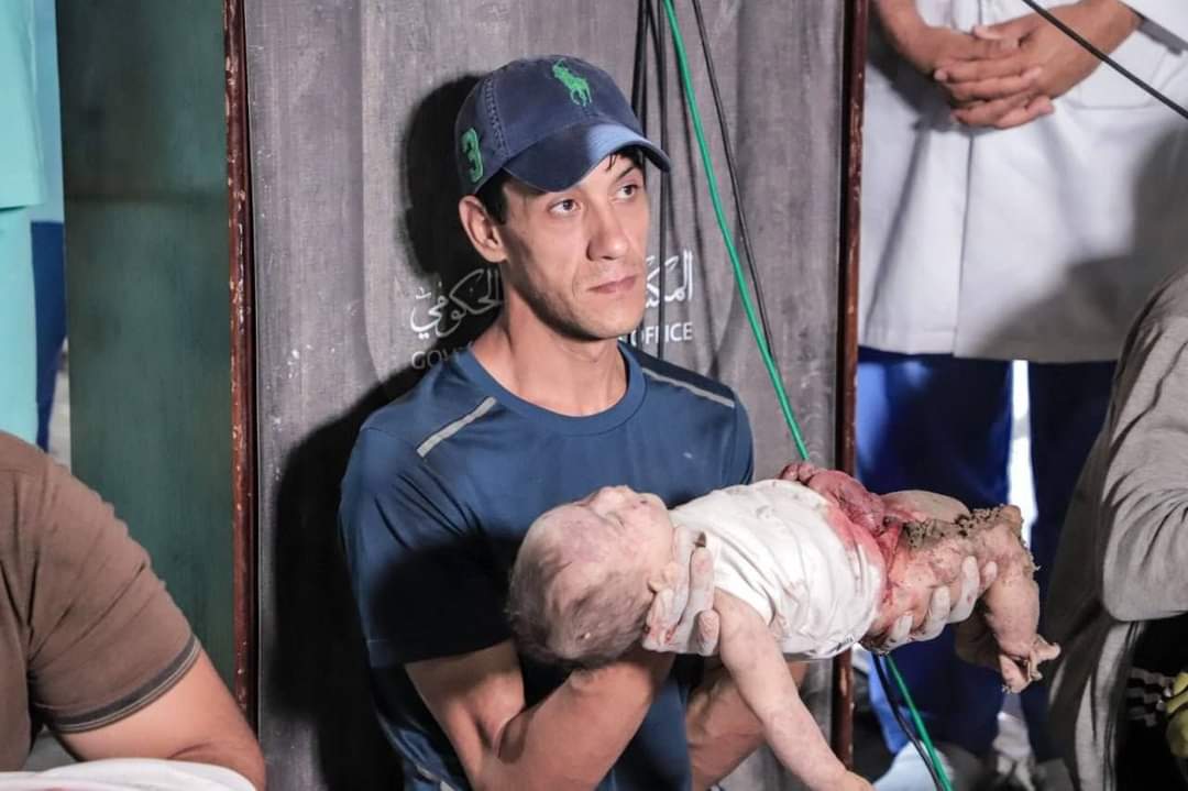 Serangan Bom Hospital Gaza : Buka Mata Dunia Kekejaman Israel