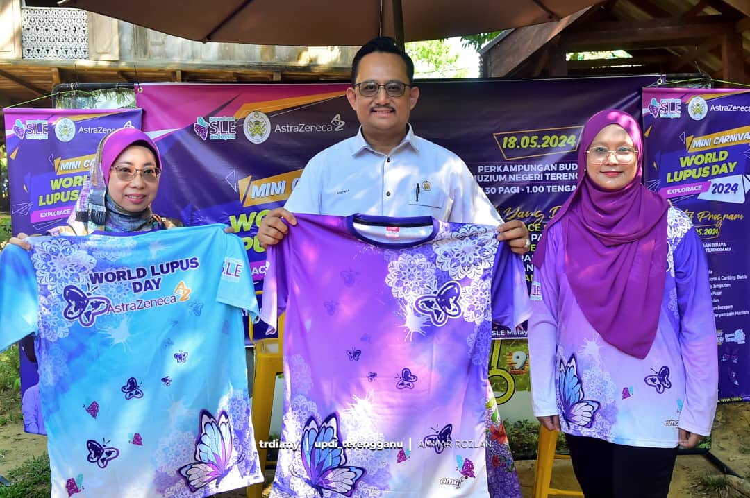 'Mini Carnival World Lupus Day' Dijangka Tarik Lebih 500 Peserta